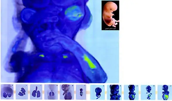 http://oloommagazine.com/images/Articles/15/SCI99b15N8-9_H03_009063.jpg