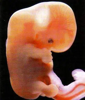 http://oloommagazine.com/images/Articles/15/SCI99b15N8-9_H03_009067.jpg