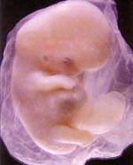 http://oloommagazine.com/images/Articles/15/SCI99b15N8-9_H03_009068.jpg