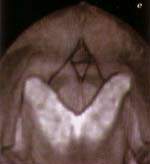 http://oloommagazine.com/images/Articles/15/SCI99b15N8-9_H03_009073.jpg