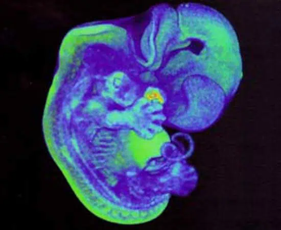 http://oloommagazine.com/images/Articles/15/SCI99b15N8-9_H03_009079.jpg