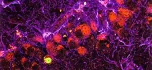 http://oloommagazine.com/images/Articles/16/SCI2000b16N5-6_H05_001153.jpg