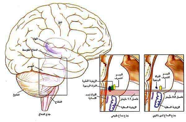 http://oloommagazine.com/images/Articles/16/SCI2000b16N5-6_H02_001130.jpg