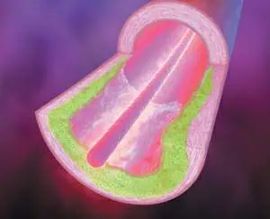 http://oloommagazine.com/images/Articles/20/SCI2004b20N1_H01_003222.jpg