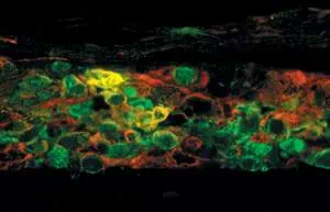 http://oloommagazine.com/images/Articles/20/SCI2004b20N1_H05_003256.jpg