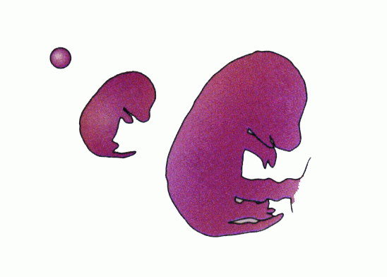 http://oloommagazine.com/images/Articles/2006/8-9/108.gif