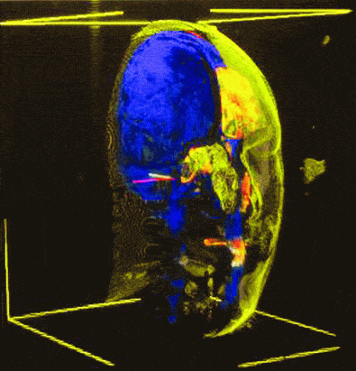 http://oloommagazine.com/images/Articles/2007/11-12/91.gif
