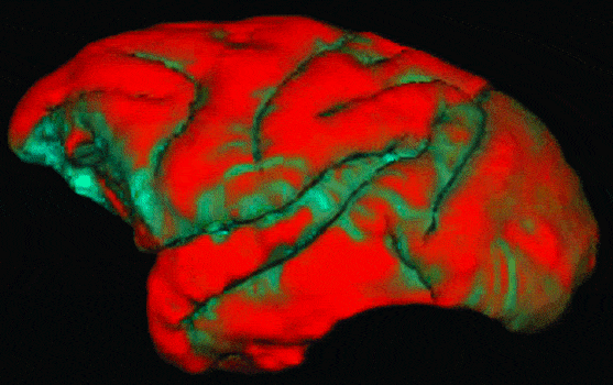http://oloommagazine.com/Images/Articles/2009/11-12/sa0209Hilg08.gif