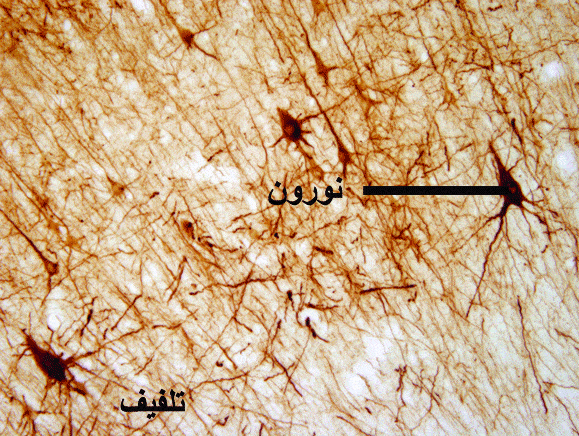 http://oloommagazine.com/Images/Articles/2009/11-12/36%20.gif