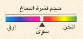 http://oloommagazine.com/images/Articles/2009/5-6/egeg.gif