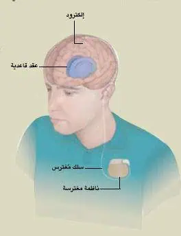 http://oloommagazine.com/images/Articles/21/SCI2005b21N9_H04_004230.jpg