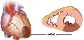 http://oloommagazine.com/images/Articles/21/SCI2005b21N9_H01_004206.jpg