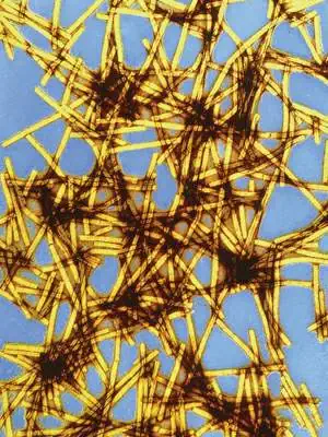 http://oloommagazine.com/images/Articles/21/SCI2005b21N12_H01_00134.gif